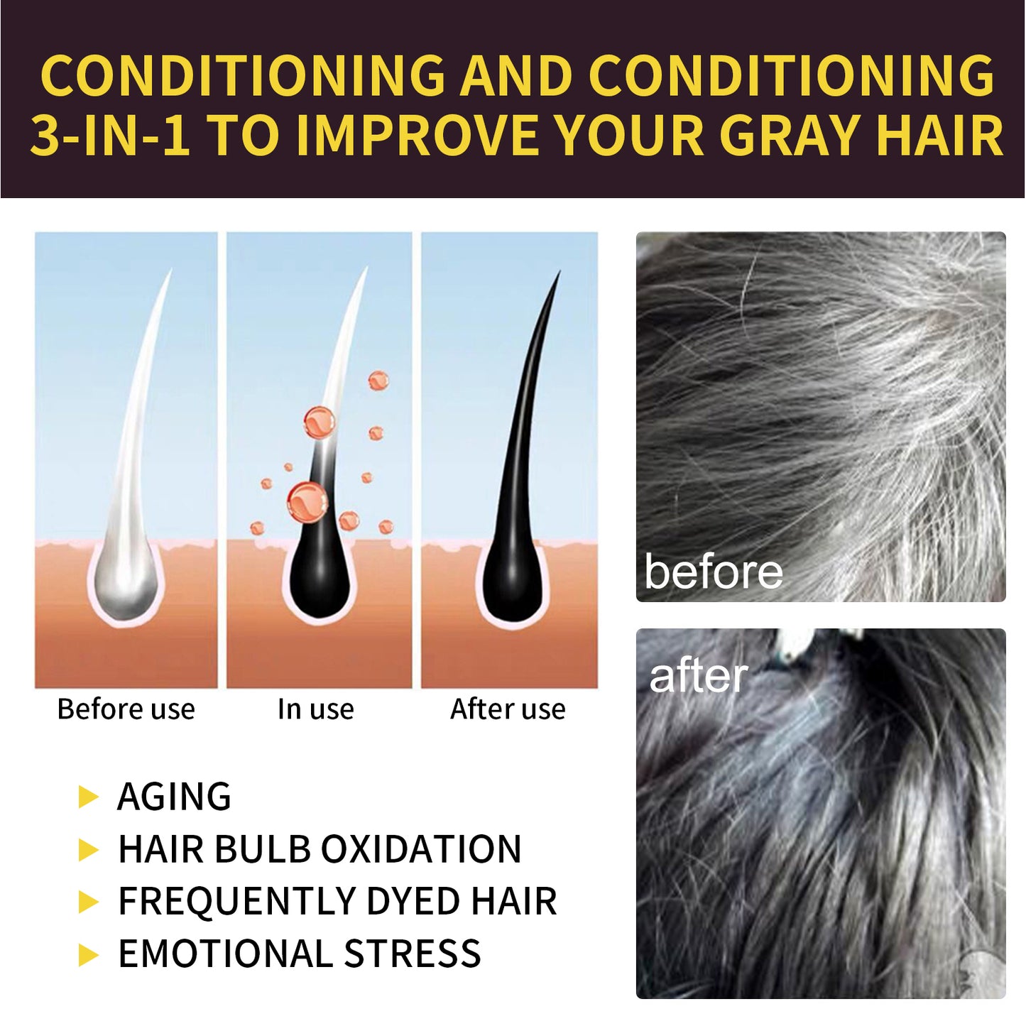 Removing Dandruff And Black Hair Shampoo Black